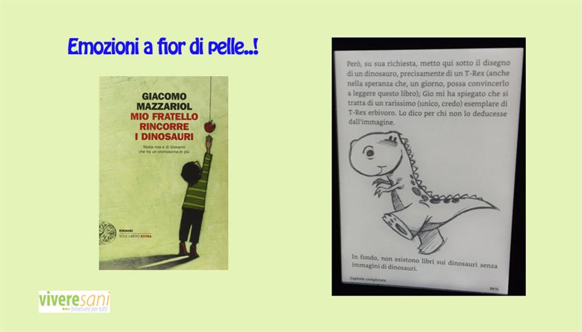Sindrome di Down Sindrome di Down